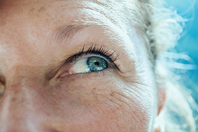 The image displays a close-up view of a person with an eye patch over their right eye, looking directly at the camera with a neutral expression.